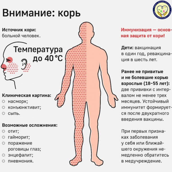 В Казахстане осложнилась эпидситуация по кори